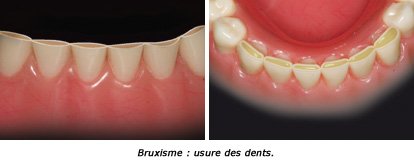 periodontal