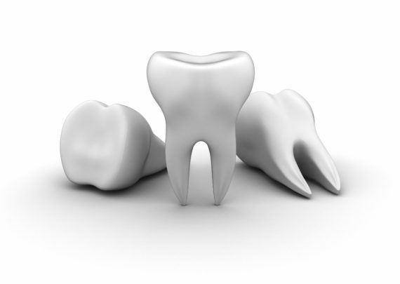 dent_manquante_dentiste_nice dent_manquante_dentiste_nice