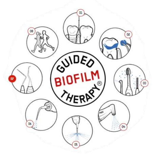 Guided-biofilm-therapy